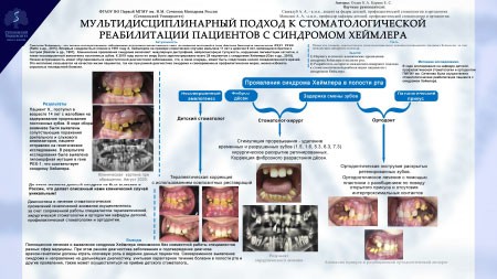 Мультидисциплинарный подход к стоматологической реабилитации пациентов с синдромом Хеймлера 